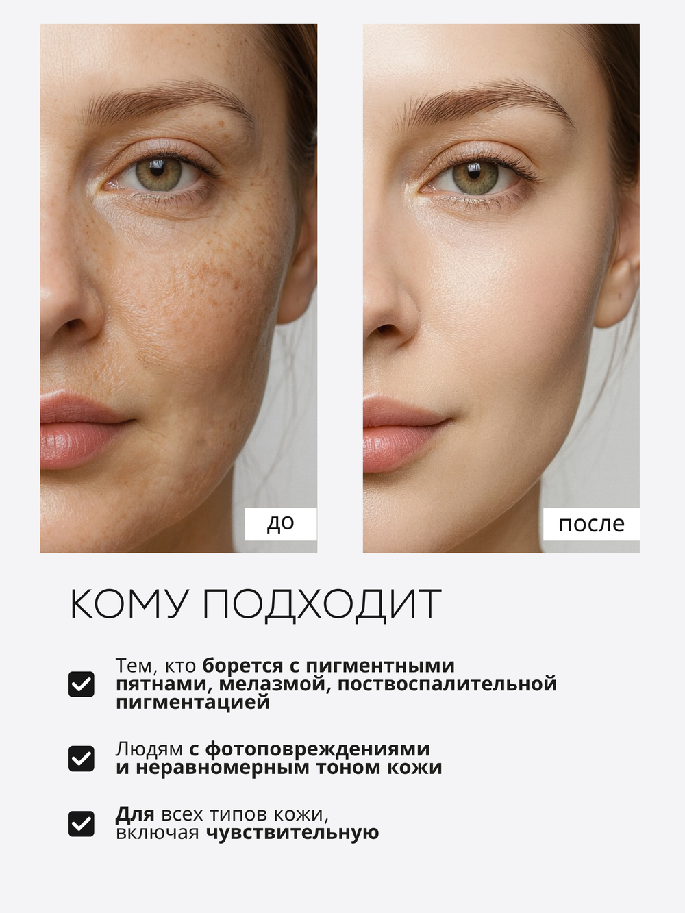 СЫВОРОТКА ОТ ГИПЕРПИГМЕНТАЦИИ