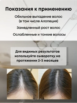 Лосьон - сыворотка для роста волос