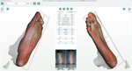 Ортопедический 3D сканер ScanPod3D USOL-X Floor