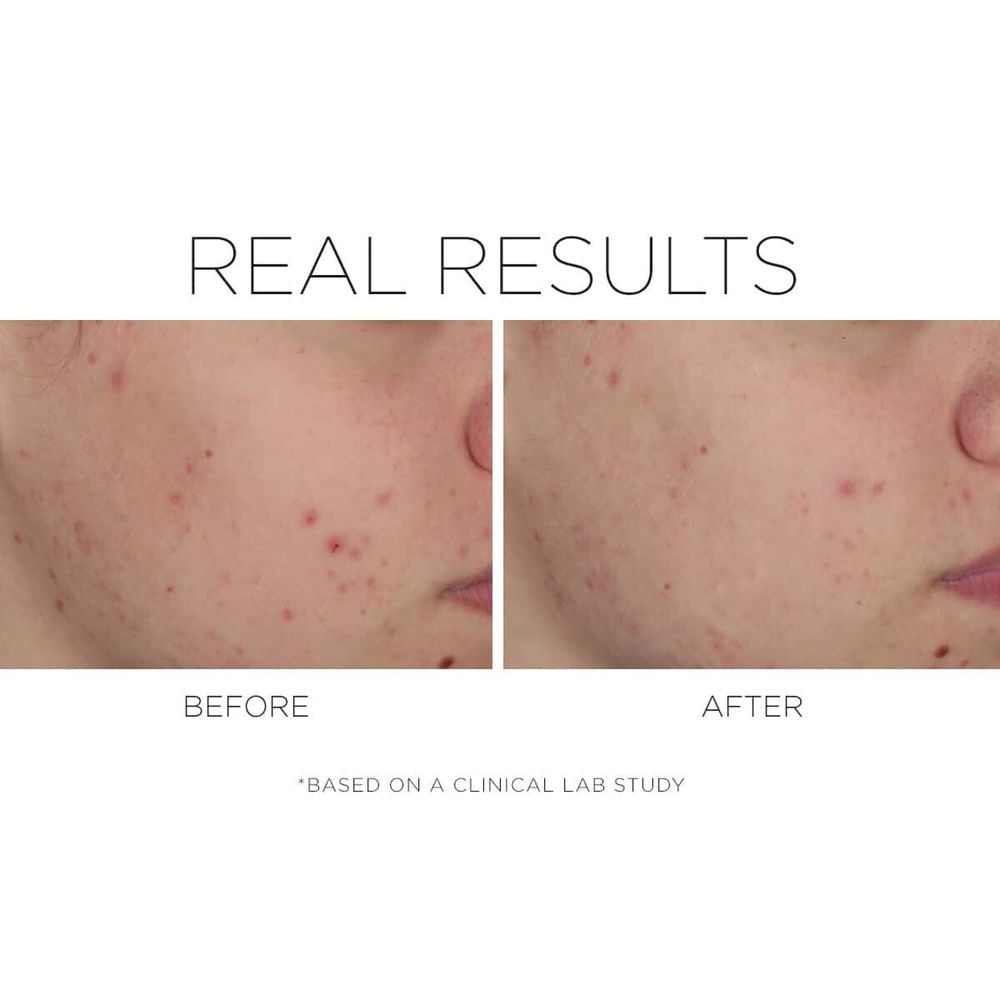 Крем Cosmedix SHINELESS Oil free moisturizer