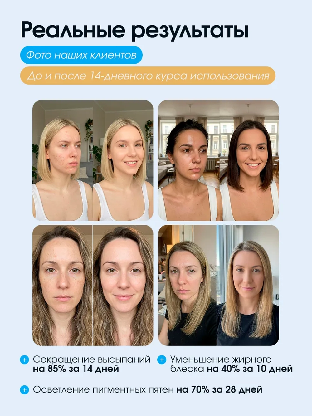 Светодиодная Led маска косметическая для фототерапии лица