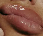 Пептидный бальзам для губ "Ваниль" RHODE SKIN PEPTIDE LIP TREATMENT - RHODE VANILLA