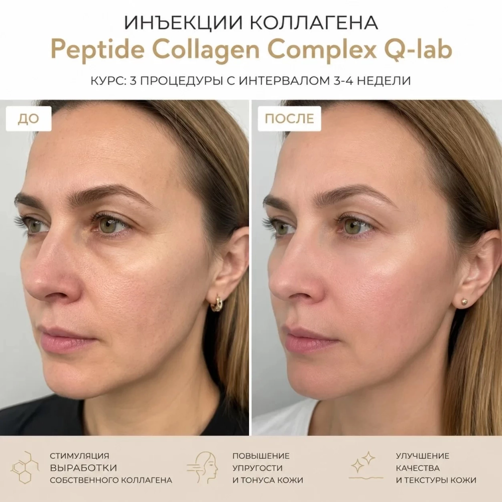 Peptide Collagen Complex Q-lab | Пептидный коктейль с коллагеном