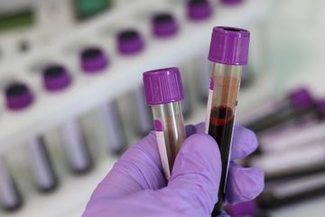 В России проведено более миллиона тестов на коронавирус