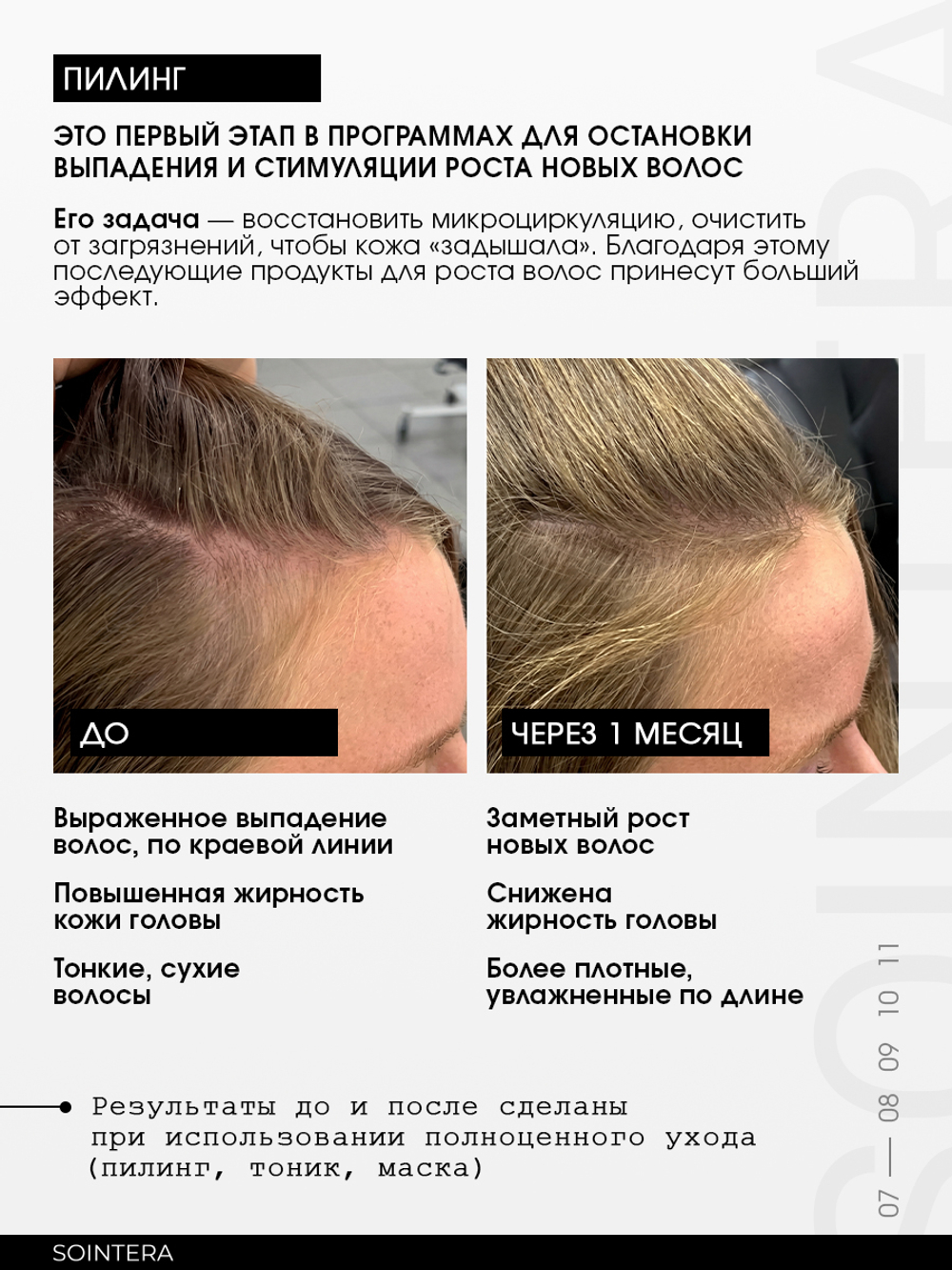 Сыворотка-пилинг для кожи головы с кислотами