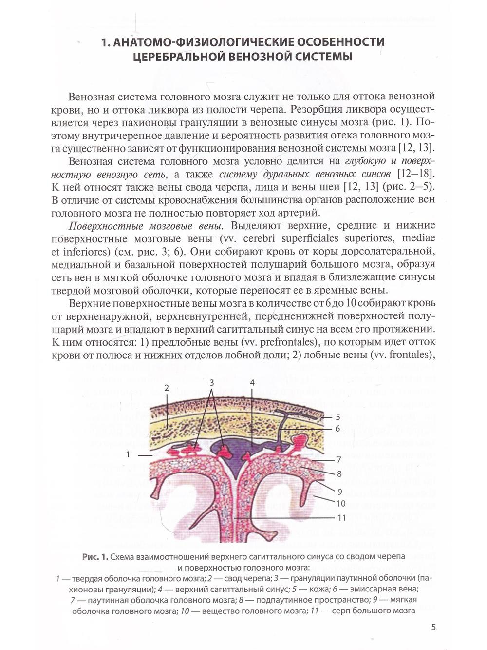 Церебральные венозные нарушения