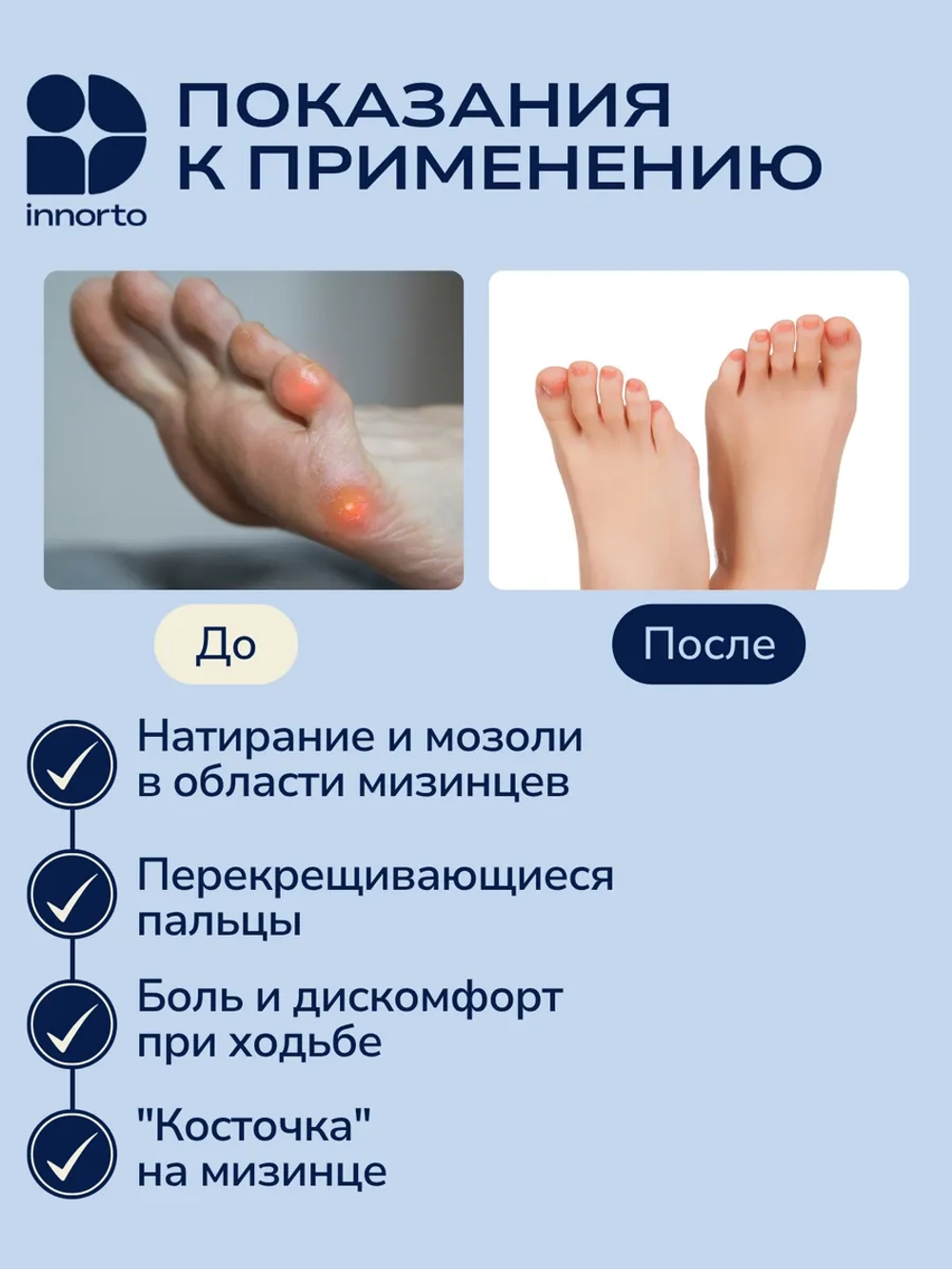 Фиксатор для мизинца ноги с разделителем и защитой косточки