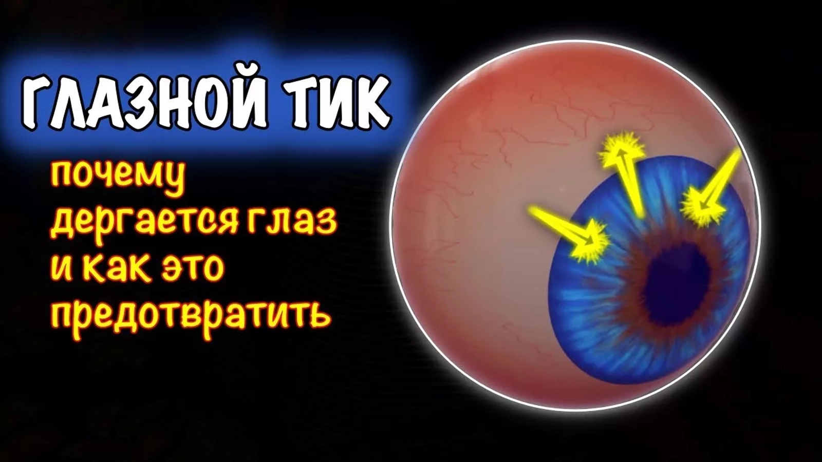 Почему глаза дёргаются? Разбираемся в причинах