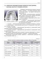 Анализ диагностических моделей челюстей
