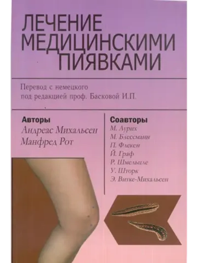 ЛЕЧЕНИЕ МЕДИЦИНСКИМИ ПИЯВКАМИ