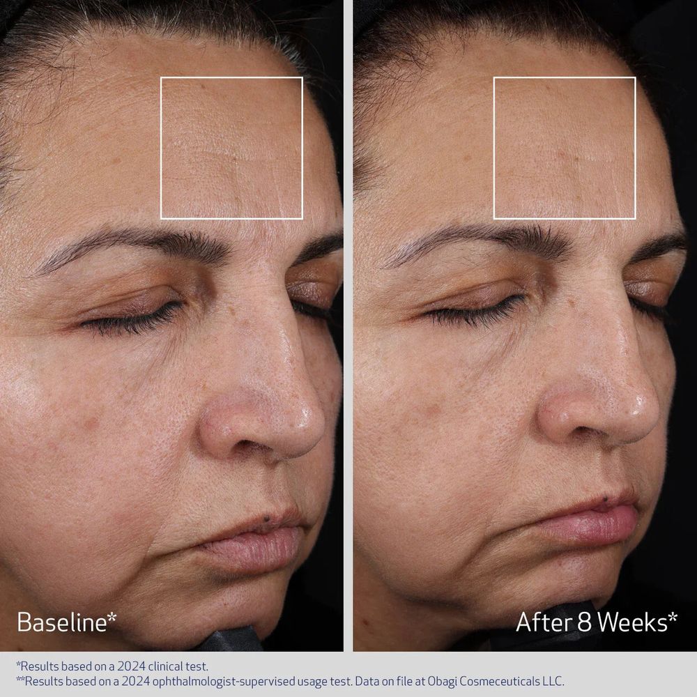 Obagi ELASTIderm Advanced Filler Concentrate Гель-концентрат от морщин 20 мл
