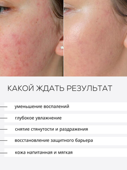 СЫВОРОТКА ДЛЯ ЧУВСТВИТЕЛЬНОЙ И РЕАКТИВНОЙ КОЖИ LAURA ZACKARYA — 2% ЭКТОИН И 2% СКВАЛАН