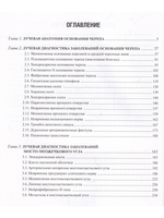Лучевая диагностика оснований черепа и мостмозжечкового угла