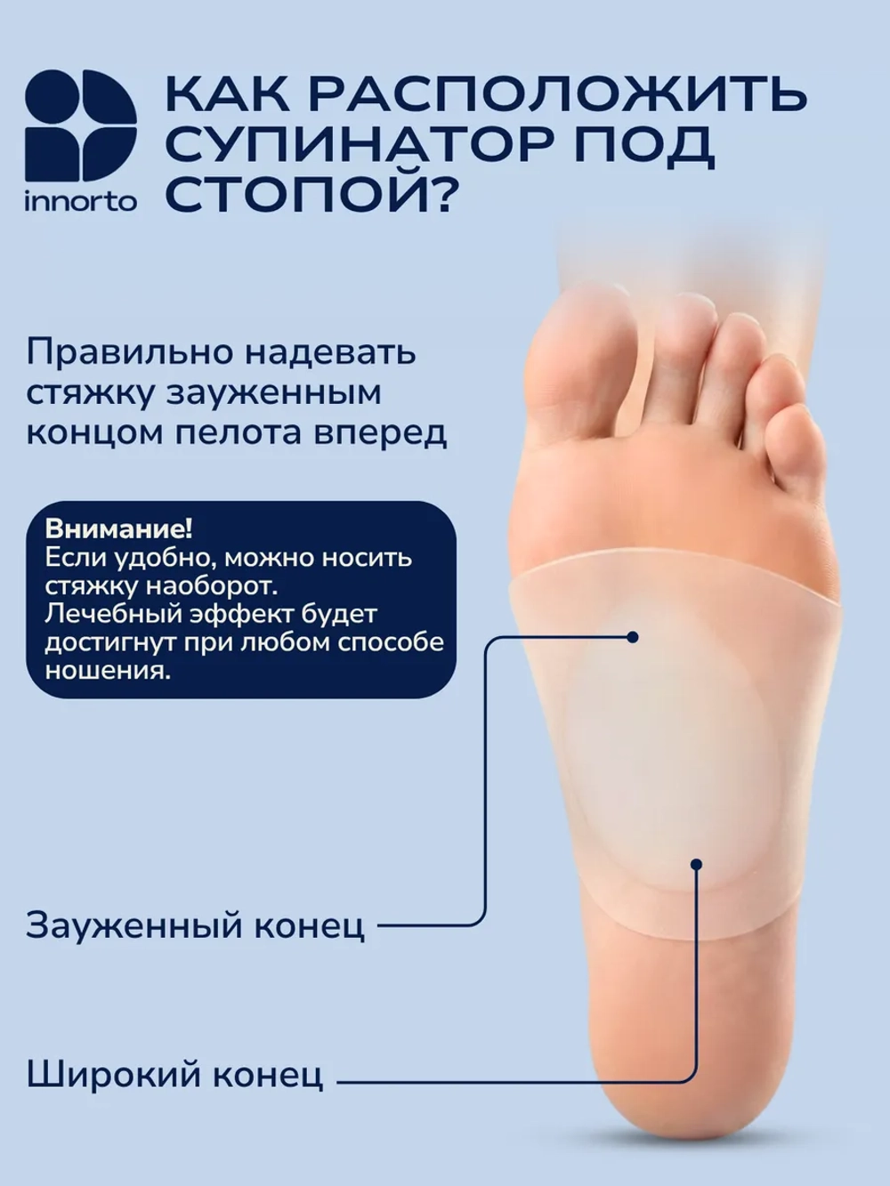 Супинаторы ортопедические при плоскостопии 51397