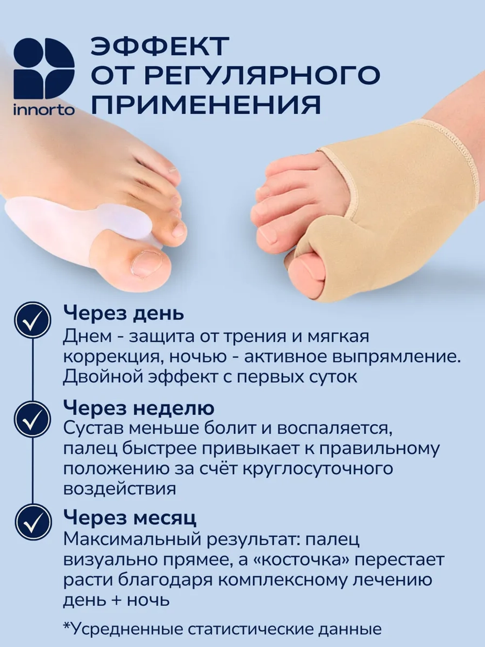 Вальгусный корректор большого пальца стопы