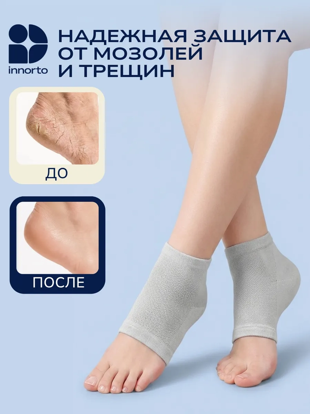 Напяточники силиконовые от трещин, 2 шт