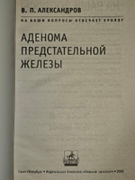Аденома предстательной железы. Александров Валерий Павлович