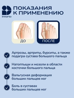 Бурсопротектор большого пальца ноги