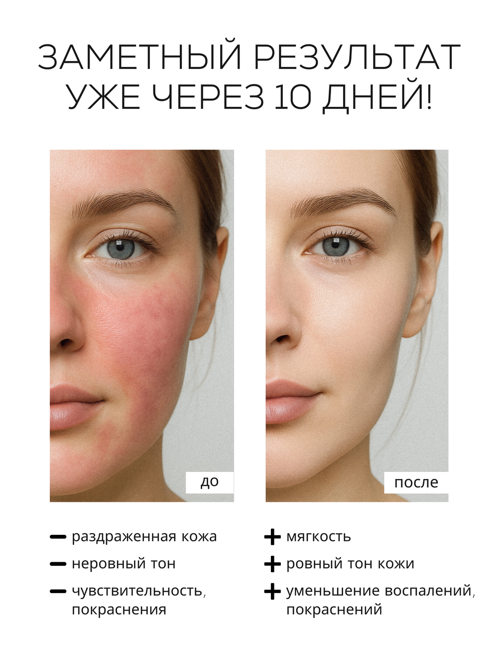 СЫВОРОТКА ДЛЯ ЧУВСТВИТЕЛЬНОЙ И РЕАКТИВНОЙ КОЖИ