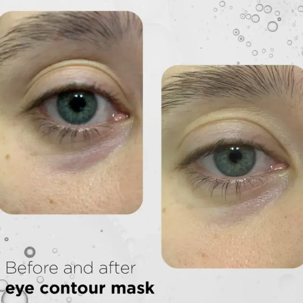 Ekseption Ultim-Eyes Mask, Крем-маска против темных кругов под глазами , 30 мл